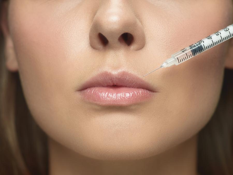 Die Vorteile von Juvederm Ultra Smile: Was Sie wissen müssen